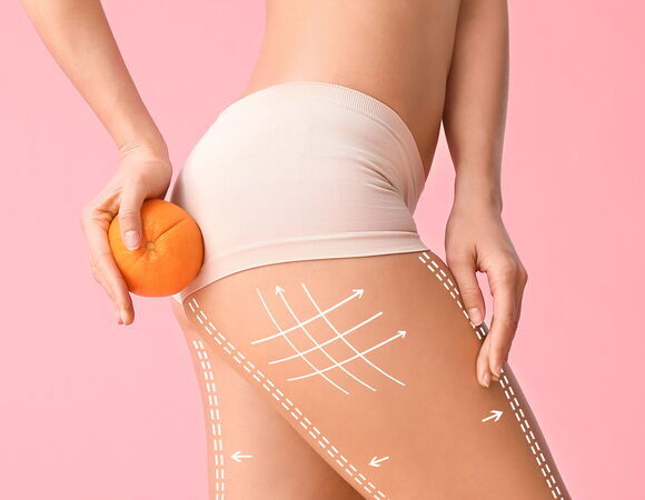 Диетолог рассказал, как женщинам избавиться от жира на бедрах Диетолог рассказал, как женщинам избавиться от жира на бедрах