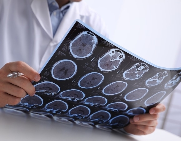 Неправильное питание признали одной из основных причин онкологии Неправильное питание признали одной из основных причин онкологии