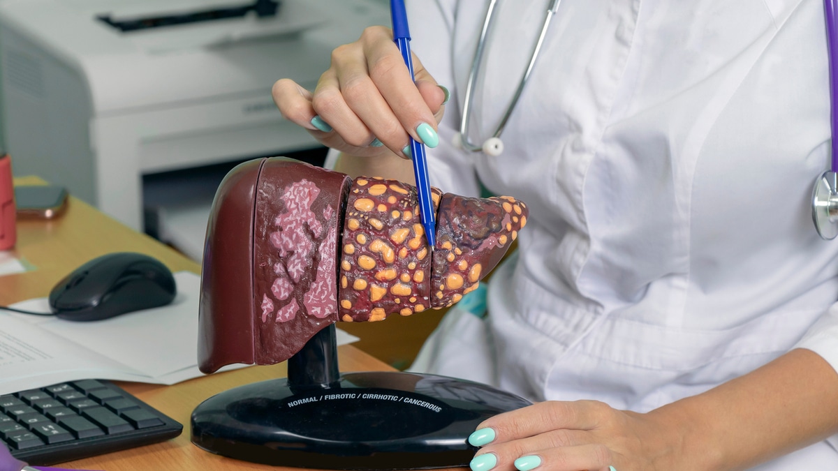 За какую еду печень не скажет «спасибо»: гастроэнтеролог За какую еду печень не скажет «спасибо»: гастроэнтеролог