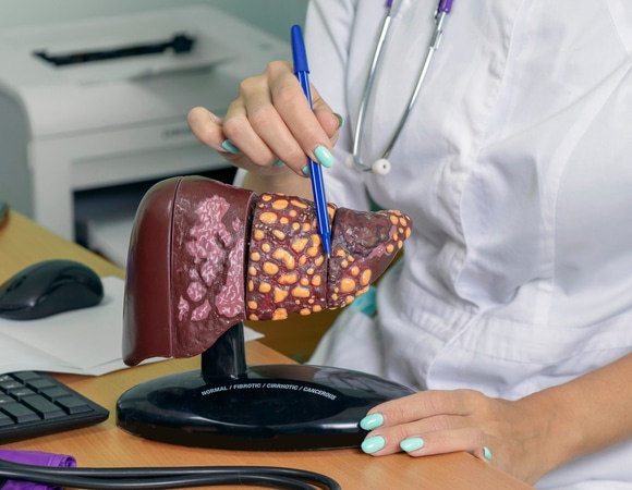 За какую еду печень не скажет «спасибо»: гастроэнтеролог