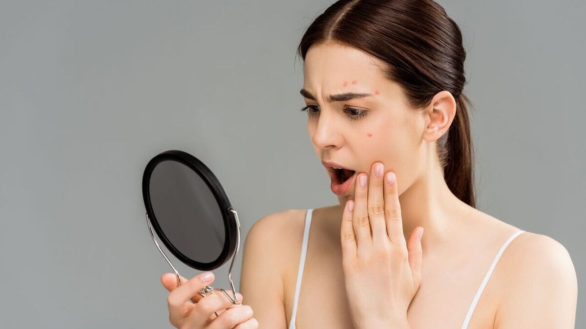 Эксперт объяснила, как едой не навредить коже лица