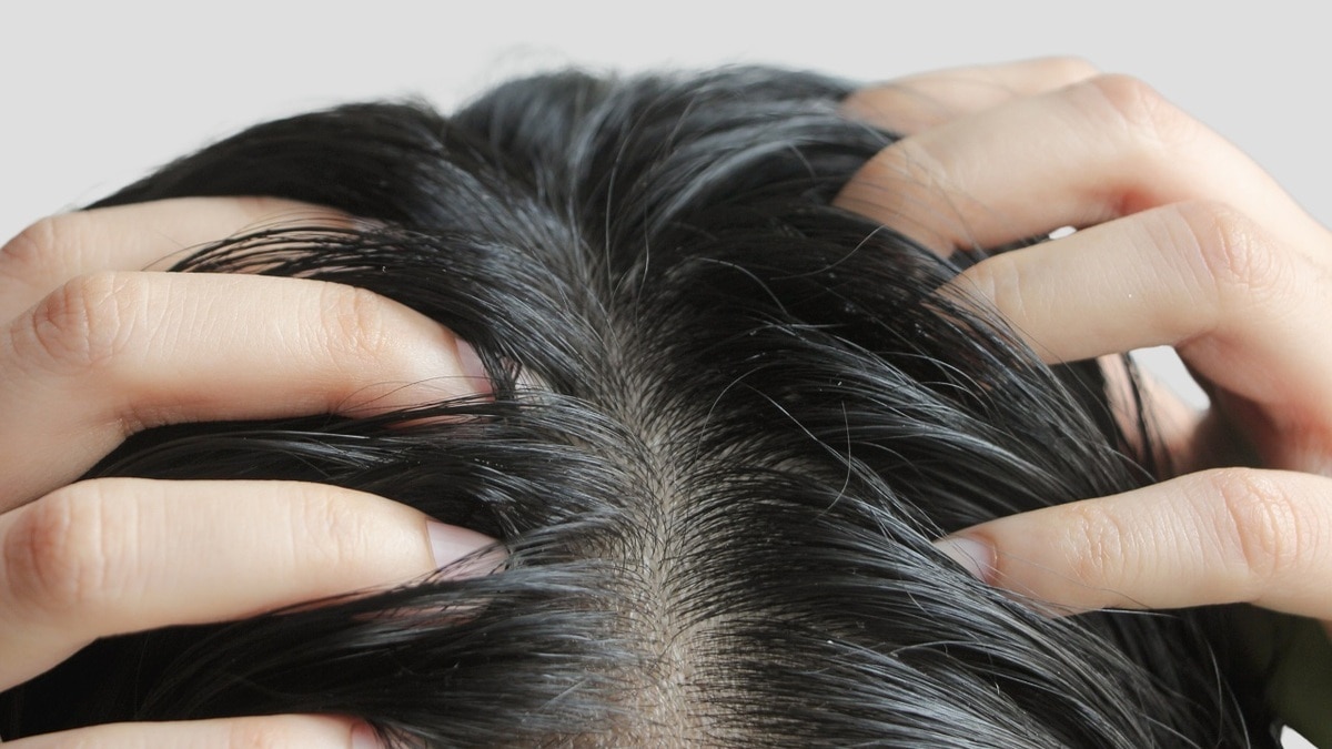 «Вечно грязная голова»: ученые выяснили, из-за какой еды волосы становятся «сальными» «Вечно грязная голова»: ученые выяснили, из-за какой еды волосы становятся «сальными»