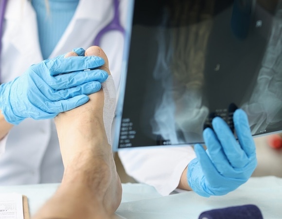 Не только мясо и алкоголь: стало известно, какие еще продукты вызывают подагру Не только мясо и алкоголь: стало известно, какие еще продукты вызывают подагру