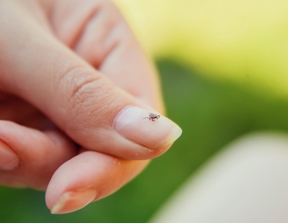 Укус клеща может вызвать аллергию — мясоедам и любителям "молочки" насторожиться 