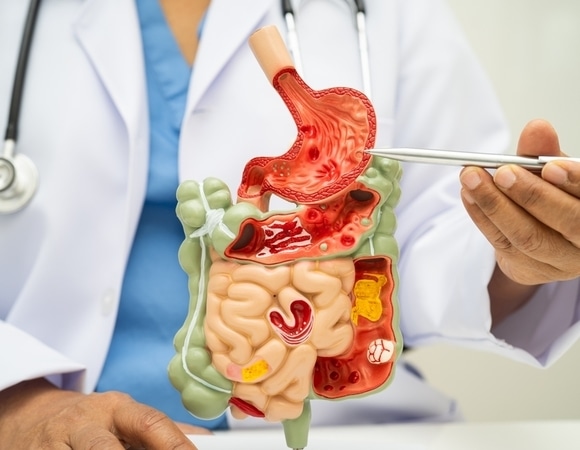 Назван список продуктов, которые не перевариваются в организме человека Назван список продуктов, которые не перевариваются в организме человека