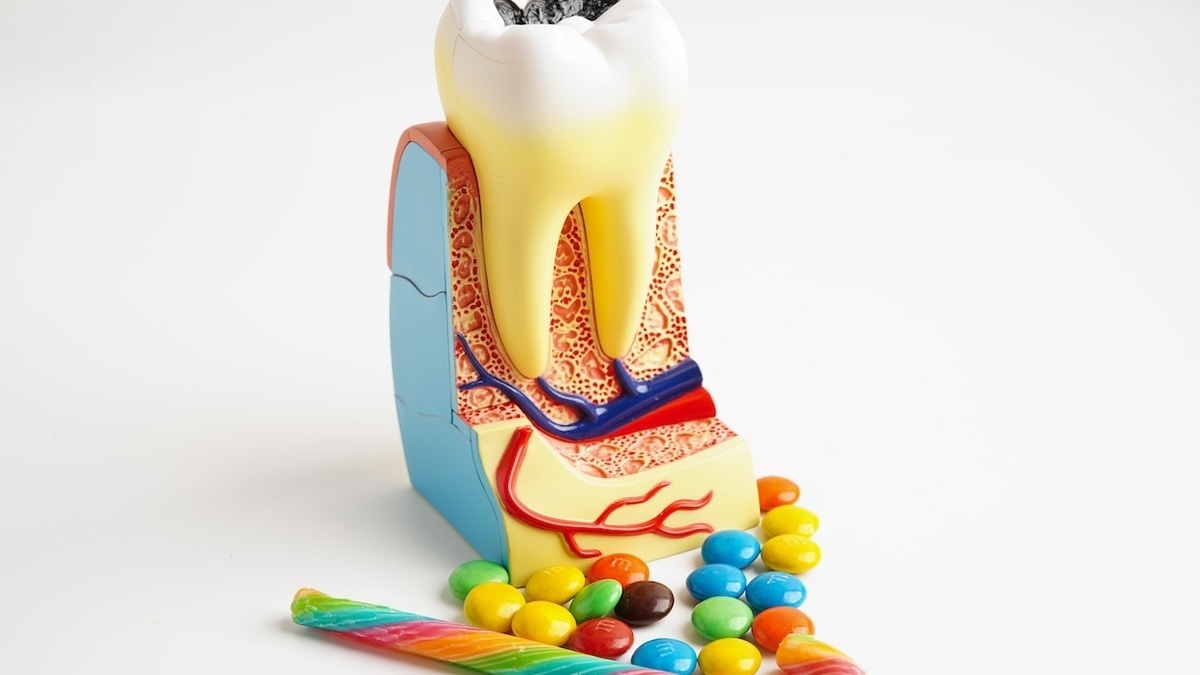 Стало известно, что на самом деле вредит зубам — сахар не на первом месте 