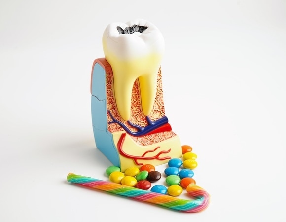 Стало известно, что на самом деле вредит зубам — сахар не на первом месте