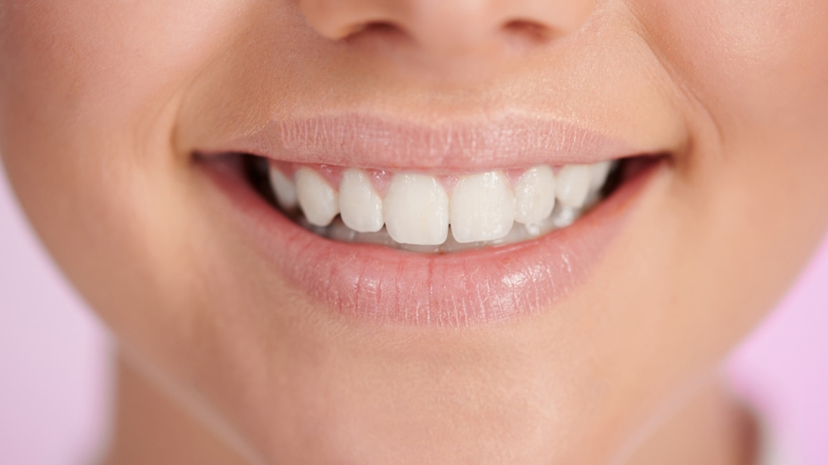 "Разъедает ослабленную эмаль": это популярное народное средство для отбеливания разрушает зубы