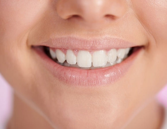 "Разъедает ослабленную эмаль": это популярное народное средство для отбеливания разрушает зубы "Разъедает ослабленную эмаль": это популярное народное средство для отбеливания разрушает зубы