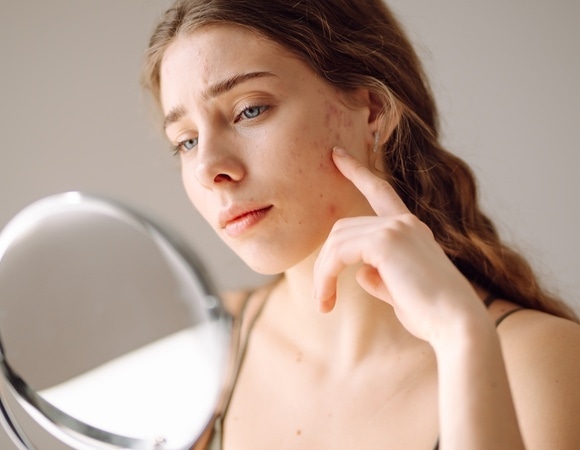 "Синдром оливье": врач-косметолог пояснила, почему после праздников кожа выглядит хуже