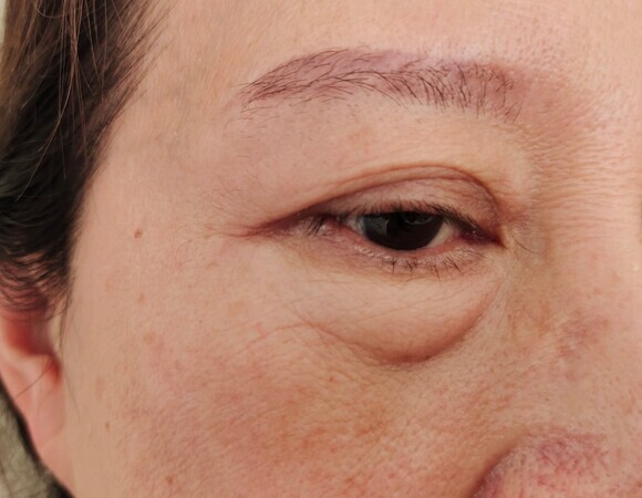 Продукты, которые нельзя есть после 6, если не хотите отеков – заявление диетолога