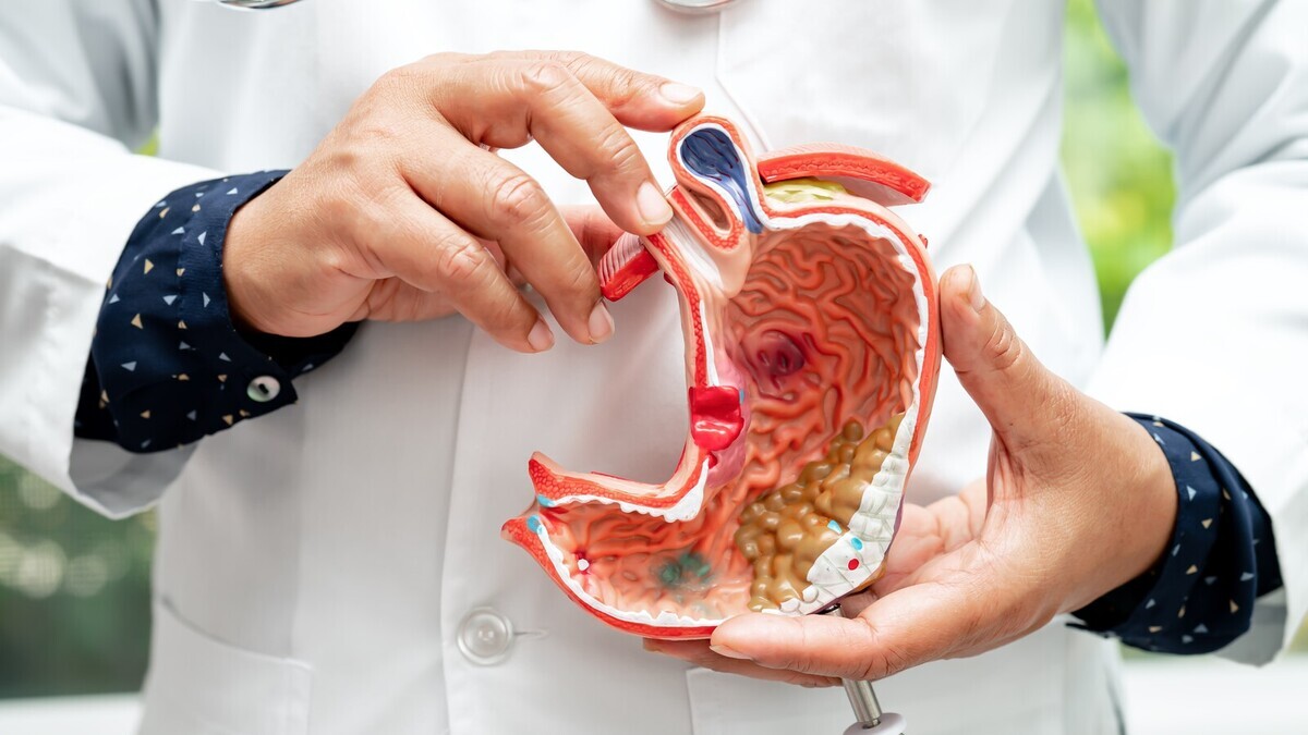 Рак желудка и кишечника "молодеет": онколог Черемушкин озвучил главные причины и способы защиты от коварной болезни 