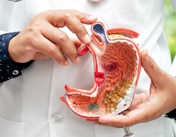 Рак желудка и кишечника "молодеет": онколог Черемушкин озвучил главные причины и способы защиты от коварной болезни 