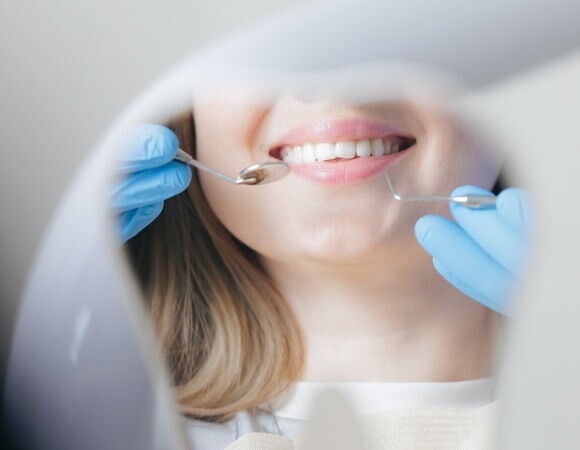 От чего надо отказаться до и после профессиональной гигиены зубов — ответила стоматолог Мелехова 