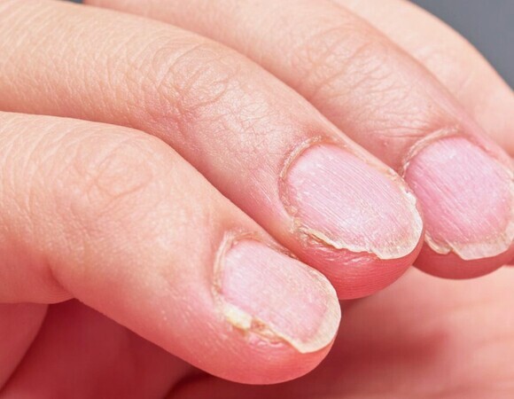 Питание для крепких ногтей: каких витаминов и микроэлементов не хватает организму