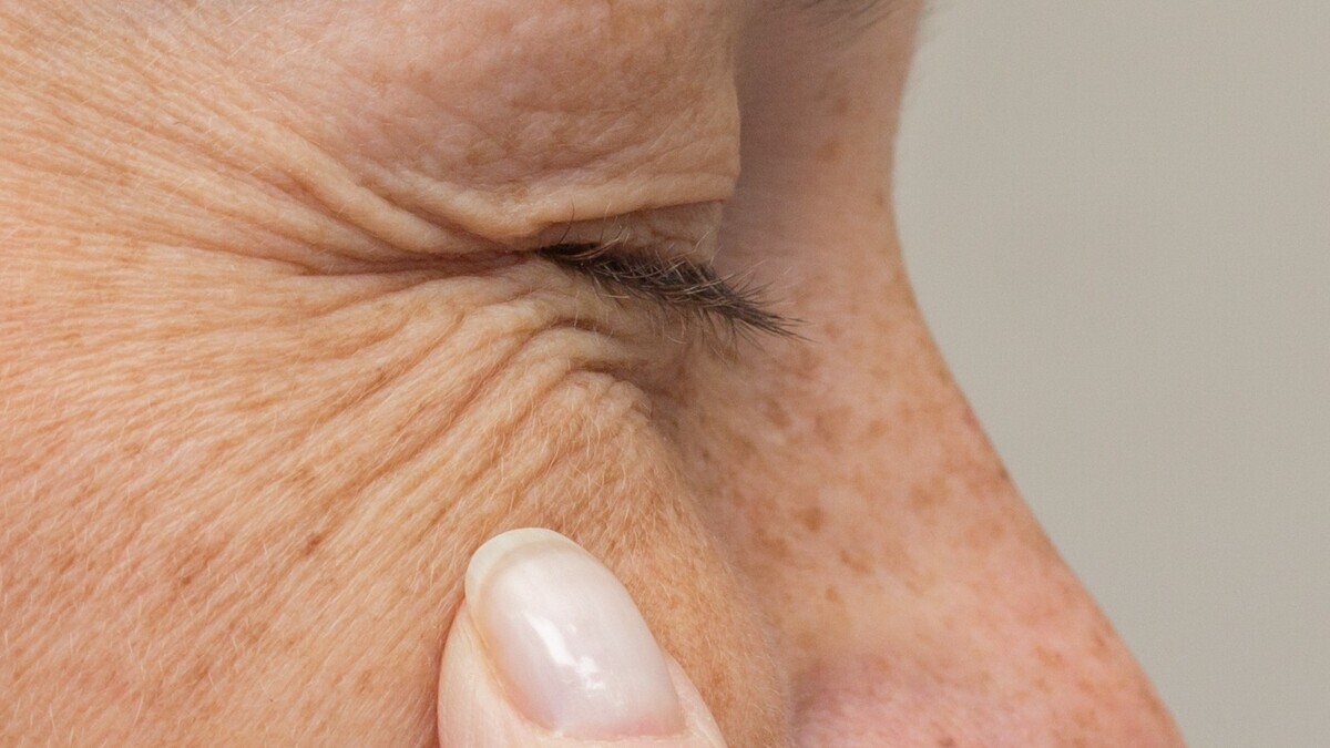 "Гусиные лапки": косметолог рассказала, как бороться с морщинами под глазами