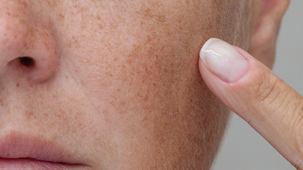 Пигментация после 40: 3 компонента в составе крема, которые реально осветляют